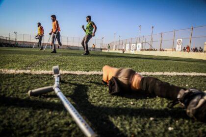 Juventus da Mooca lança equipe de futebol para atletas amputados